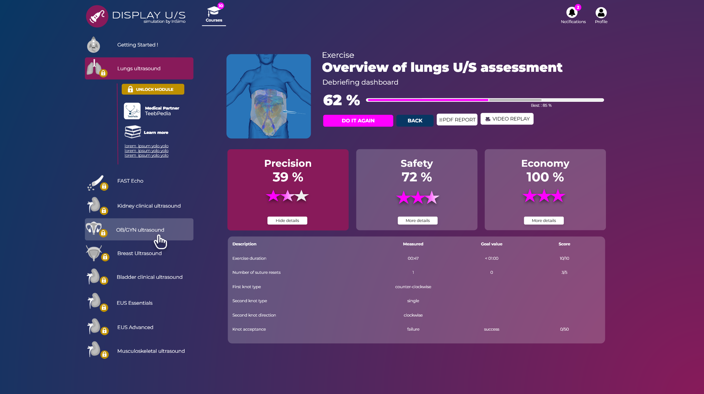 Tableau de bord de résultats de simulation InSimo